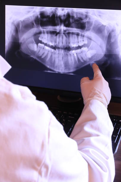 Best Emergency Root Canal Treatment in Neptune City, NJ
