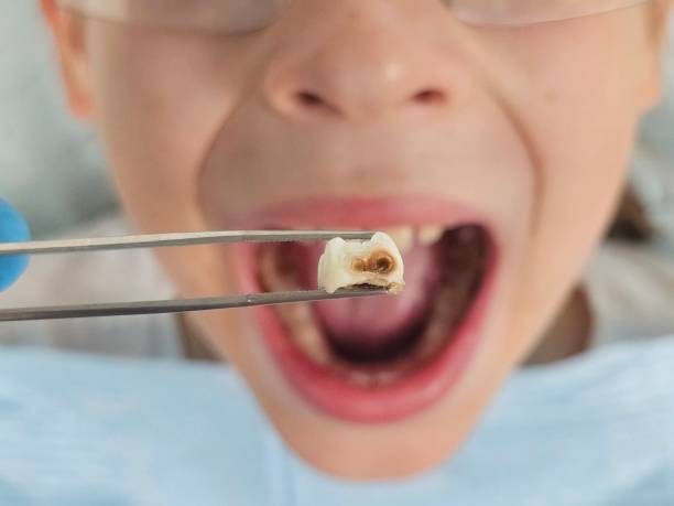 Best Pediatric Emergency Dentist in Neptune City, NJ